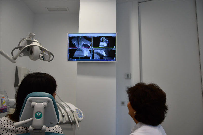Uc dentistas radiografías digitales