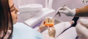 Implante dental mantenimiento